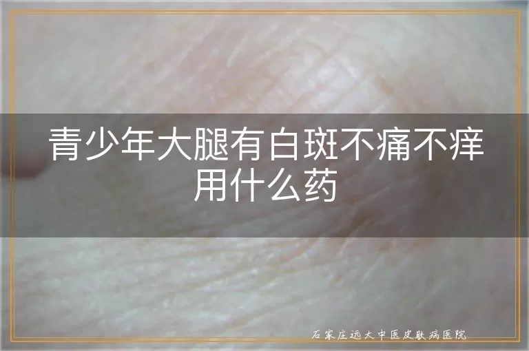 青少年大腿有白斑不痛不痒用什么药