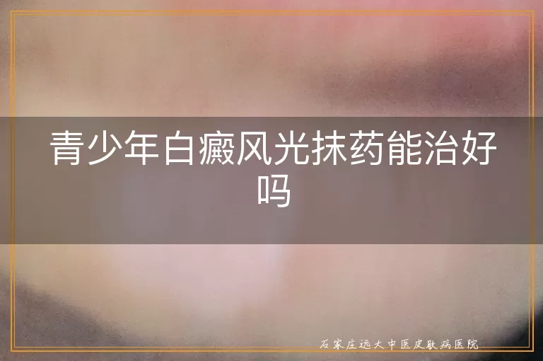 青少年白癜风光抹药能治好吗