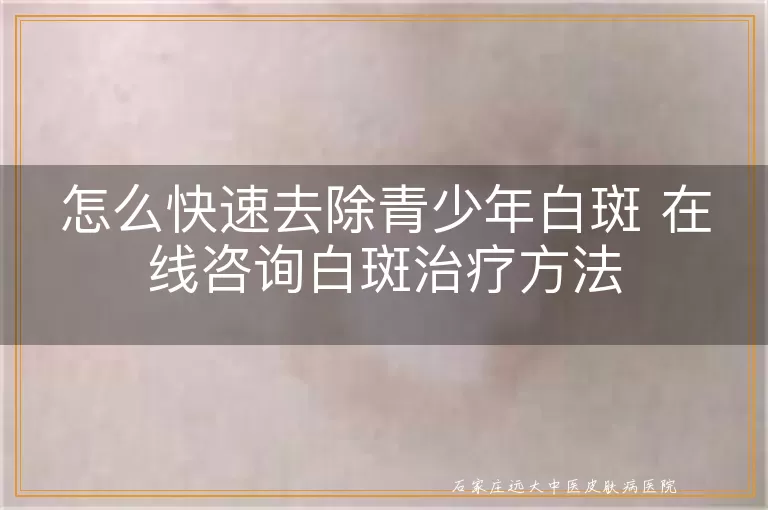 怎么快速去除青少年白斑 在线咨询白斑治疗方法
