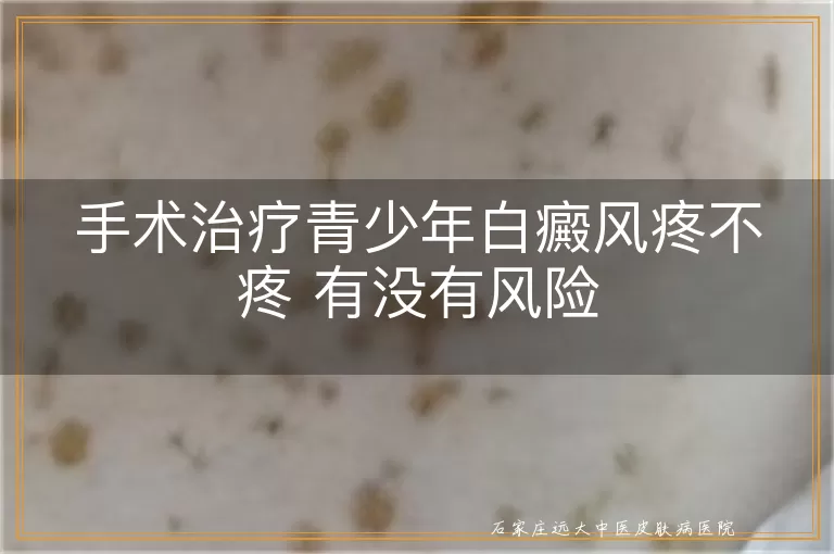 手术治疗青少年白癜风疼不疼 有没有风险