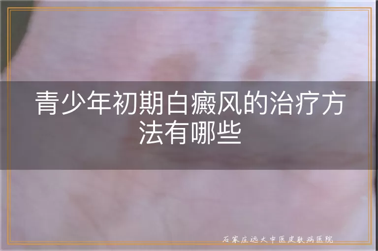 青少年初期白癜风的治疗方法有哪些