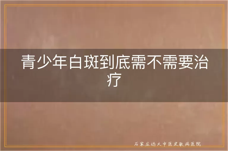 青少年白斑到底需不需要治疗