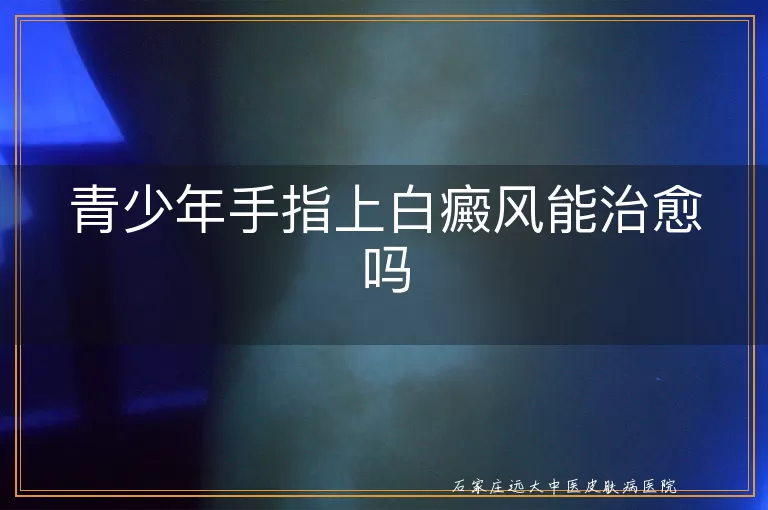 青少年手指上白癜风能治愈吗
