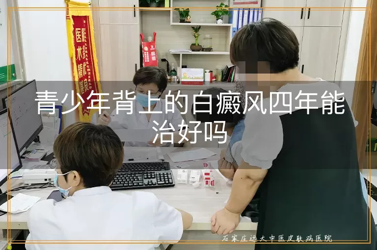 青少年背上的白癜风四年能治好吗