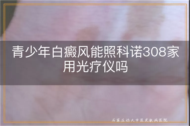 青少年白癜风能照科诺308家用光疗仪吗