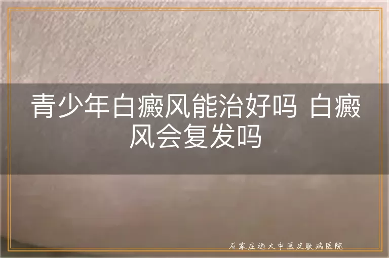 青少年白癜风能治好吗 白癜风会复发吗