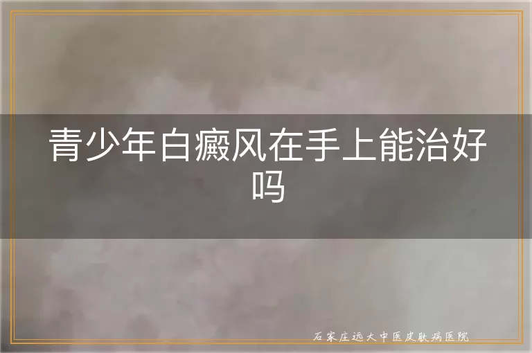 青少年白癜风在手上能治好吗
