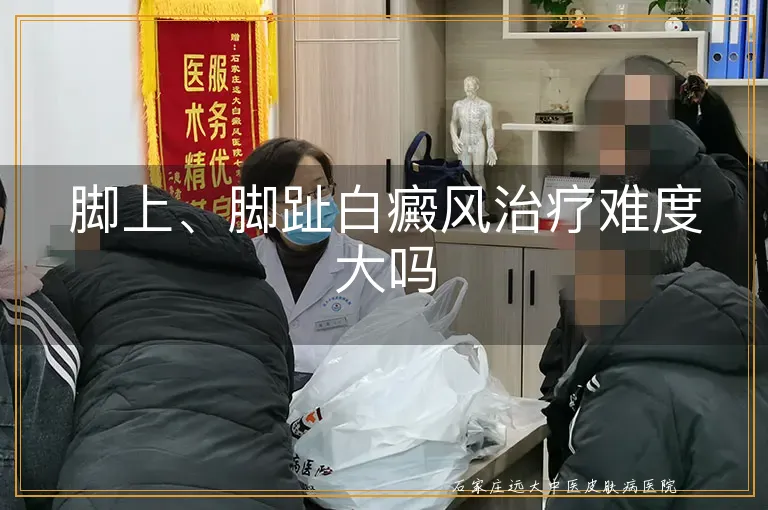 脚上、脚趾白癜风治疗难度大吗