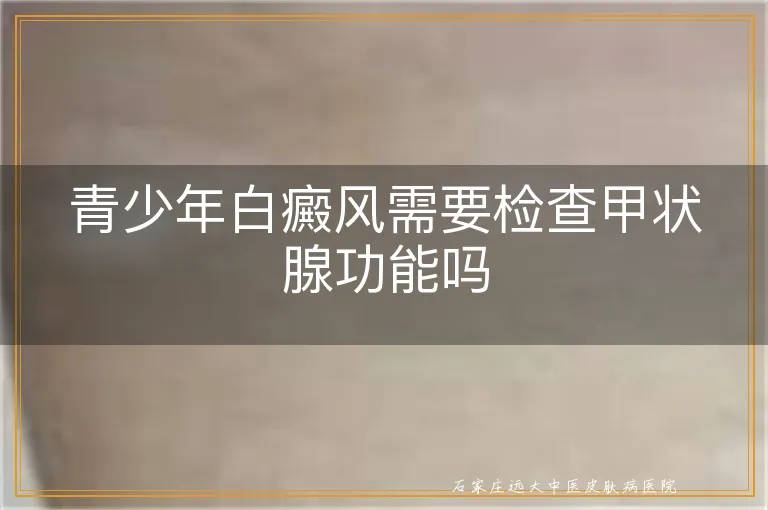 青少年白癜风需要检查甲状腺功能吗