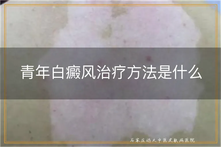 青年白癜风治疗方法是什么