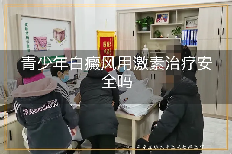 青少年白癜风用激素治疗安全吗