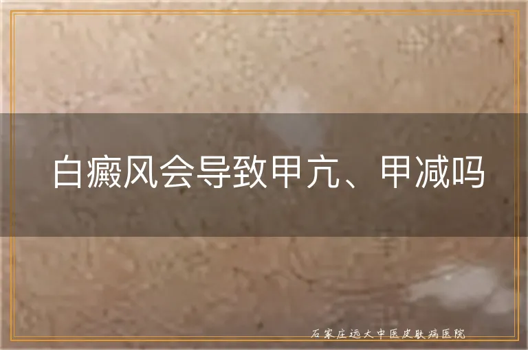 白癜风会导致甲亢、甲减吗