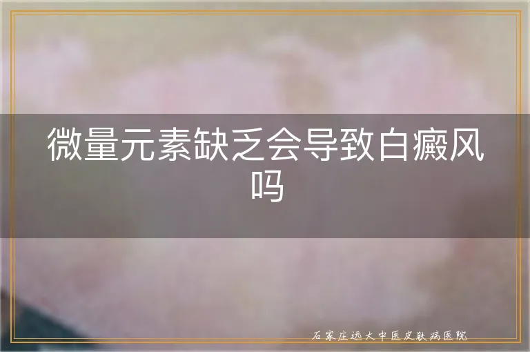 微量元素缺乏会导致白癜风吗