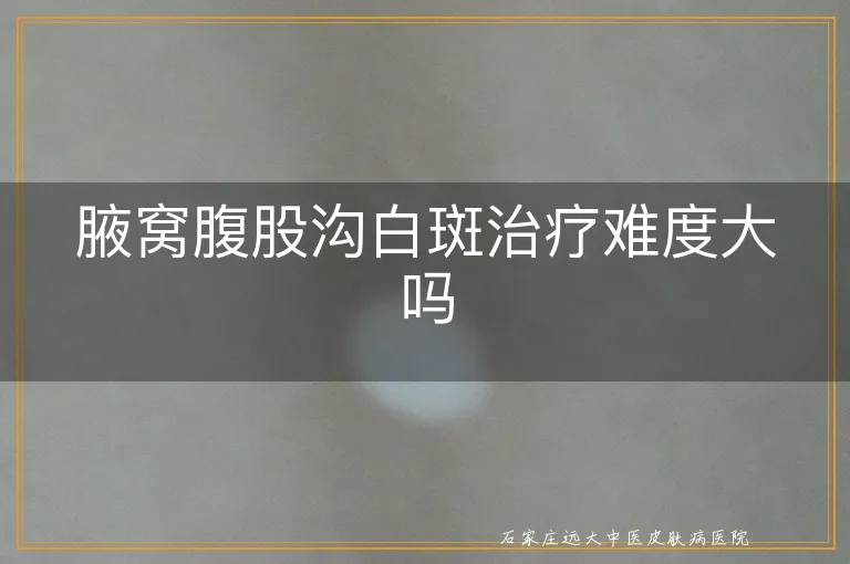 腋窝腹股沟白斑治疗难度大吗