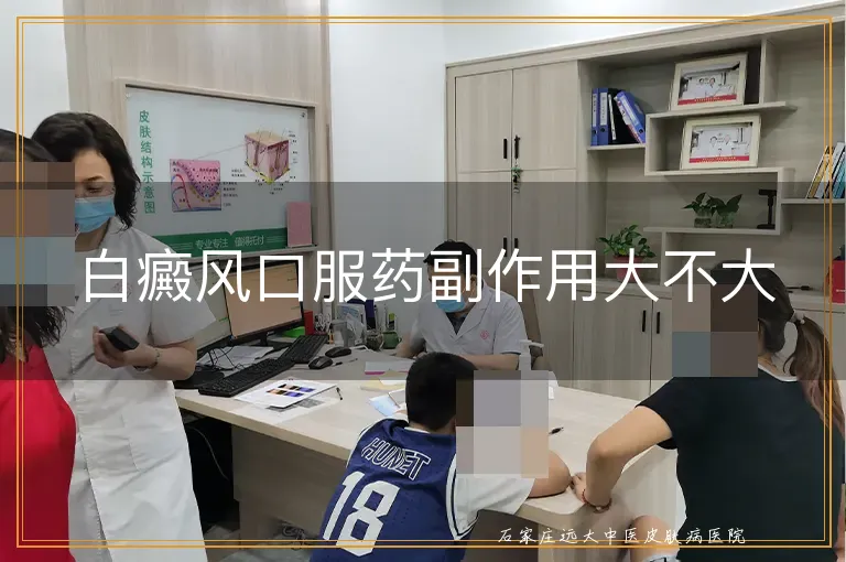 白癜风口服药副作用大不大