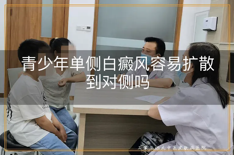 青少年单侧白癜风容易扩散到对侧吗