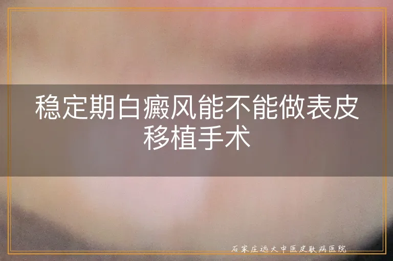 稳定期白癜风能不能做表皮移植手术