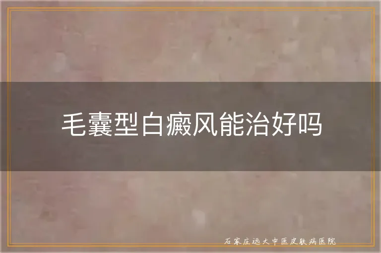 毛囊型白癜风能治好吗