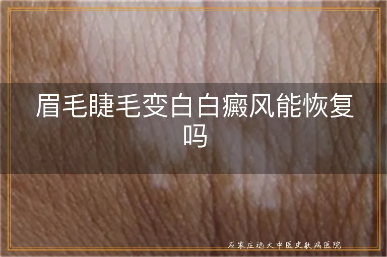 眉毛睫毛变白白癜风能恢复吗