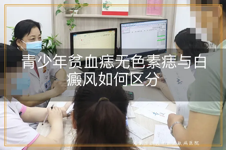 青少年贫血痣无色素痣与白癜风如何区分