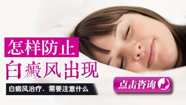 有效治疗白癜风的好方法有哪些